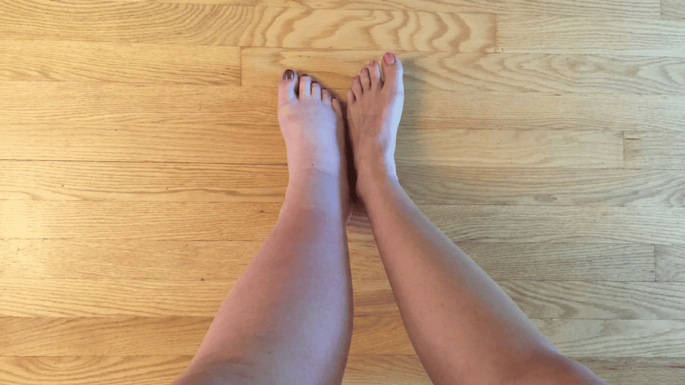 Jambes et chevilles gonflées